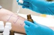 Tests de intolerancias alimentarias, promesas sen fundamento