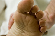 Botulismo / Consumo excesivo de bebidas de cola / Los gatos potencian los síntomas de alergia / Leche de cabra contra la anemia ferropénica / Entrevista: Manuel Martínez Lavín